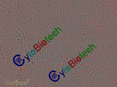 红色荧光标记细胞核的人前列腺癌细胞系（Du145-makte2）