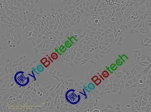 12107-RBE抗性筛选照片_B8_2_2021y10m07d_11h03m.jpg