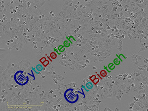 12107-RBE抗性筛选照片_B8_2_2021y10m08d_10h19m.jpg