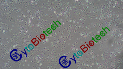 原代小鼠肝窦内皮细胞（M-SEC，18月龄鼠）