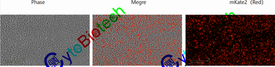红色荧光标记细胞核的人前列腺癌细胞（LNCaP-mkate2）
